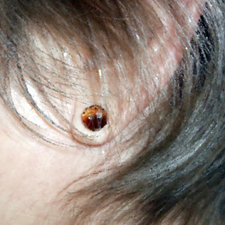 Hypo-allergenic Titanium Earring Posts.jpg